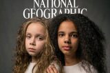 ‘Pensam que somos apenas melhores amigas’: as gêmeas que nasceram com a cor da pele diferente