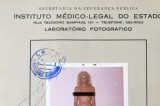 ‘Monstro, prostituta, bichinha’: como a Justiça condenou a 1ª cirurgia de mudança de sexo do Brasil e sentenciou médico à prisão