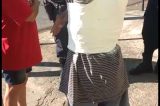 [Vídeo] Veja que presepada: Engessaram o ombro e braço de paciente por cima da camisa