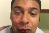 Vereador com sintomas de embriaguez se envolve em confusão com PM