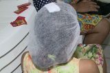 Mãe encontra larvas de moscas na cabeça da filha em Paulista