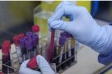 Cientistas dão passo promissor em direção a vacina contra o HIV