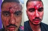 Jovem é atacado e ameaçado com arma por dois suspeitos que não queriam “viadinho” na Penha