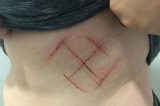 Jovem que usava camiseta estampada com #EleNão tem barriga cravada com suástica por suspeitos