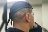 Mãe de suspeito dá pancada na cabeça de policial militar durante a prisão do filho