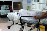 Adolescente teve o corpo queimado com óleo pela própria mãe