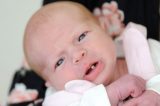 Bebê chama a atenção de família ao nascer com dente de leite