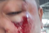 Torcedor do Vitória é agredido e tem camisa roubada Torcedor do Vitória é agredido e tem camisa roubada