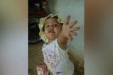 Menina de 3 anos morre vítima de bala perdida no Grande Recife