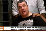 Ator Gerson Brenner dorme por 40 horas; médicos estão preocupados