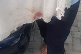 Motorista cospe em rosto de mulher e a agride durante briga de trânsito