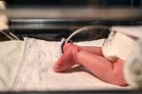 Ictiose arlequim, a rara doença genética de bebê abandonado em hospital na Itália