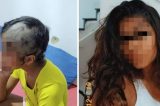 Bombeiro agride e raspa o cabelo da filha após ver vídeo com cigarro e bebida