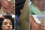 Jovens negros denunciam racismo e agressões por seguranças em bar na Pedra do Sal