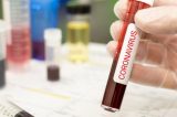 Coronavírus: Mais de 57.000 infectados e 4.700 mortes em PE
