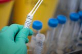 Reino Unido aprova teste de anticorpos com 100% de precisão