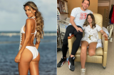 Miss Colômbia tem perna amputada após cirurgia no estômago
