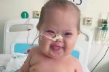 Conheça o Super Chico, bebê com síndrome de down que venceu o coronavírus