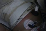 Enfermeira deu banho quente de 50 graus em menina que teve o corpo queimado no Hospital Getulinho, diz polícia