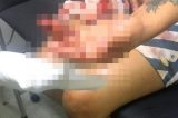 Mulher agredida com golpes de facão