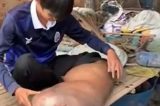 Homem fica com perna gigantesca após infecção por picada de mosquito; assista