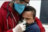 Paciente com Down fotografado em abraço com enfermeiro morre no Amazonas por falta de UTI