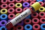 Universidades brasileiras testam eficácia de vacina contra o HIV