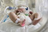 “10 vezes mais do que EUA”: por que tantos bebês morrem por Covid-19 no Brasil