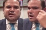 Cacá Leão sofre paralisia facial e brinca: “Não tem uma ruga”