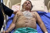 Após cirurgia no nariz, médico de Bolsonaro diz que seu intestino funciona de forma adequada e descarta nova intervenção