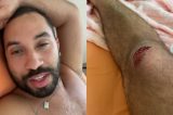 Gil do Vigor sofre acidente de bicicleta nos EUA: ‘Quase desmaiei’