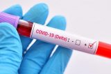 Após Natal e Ano Novo, casos ativos de Covid em Salvador crescem 866% Após Natal e Ano Novo, casos ativos de Covid em Salvador crescem 866%