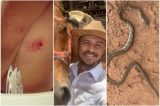 Azarado? Homem pisa em cobra venenosa após levar mordida de cavalo