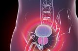 Reflexos da pandemia: diagnósticos e cirurgias de câncer de próstata têm queda