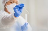 Secretaria de Saúde de Juazeiro ressalta que não possui registro de Influenza