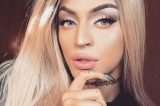 Pabllo Vittar surge nas redes sociais com olho roxo e curativo