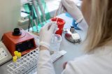 Para evitar falta de testes, laboratórios são orientados a reservá-los a casos graves