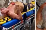 Ex-vice-prefeito de Olinda, do PT, é brutalmente agredido por vizinho bolsonarista