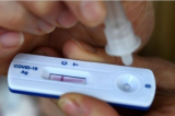 Vendas de autoteste de Covid aumentam mais de 1.500% em farmácias