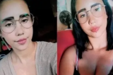 Jovem coloca piercing na boca e morre com infecção no cérebro