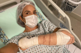 Ivete Sangalo passa por cirurgia no braço e comemora: ‘Mainha tá zero bala’