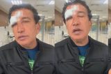 Com ferimentos no rosto, senador Magno Malta é hospitalizado na Bahia