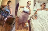 Médicos brasileiros retiram quase 35 kg de tumor de mulher com doença rara