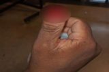 Mulher é presa após arrancar dedo de policial durante abordagem