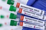 ‘Mpox fulminante’ ameaça pacientes com Aids, alertam pesquisadores 