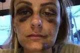 Ex-namorada do surfista JP Azevedo, que agrediu americana, relata episódio de violência Ex-namorada do surfista JP Azevedo, que agrediu americana, relata episódio de violência