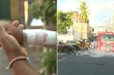 Criança é atingida por tiro dentro de casa na Bahia