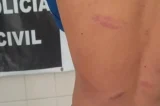 Estudante é agredido por colegas na Bahia; caso teria ocorrido após vítima curtir foto de colega