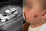 PM atira em rosto de menina de 1 ano com arma de airsoft em São Paulo