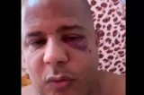 Marcelinho Carioca reaparece com sinais de tortura e diz que foi sequestrado por marido de amante (vídeo)